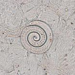 Trichinella_pseudospiralis_ISS13__GAR_