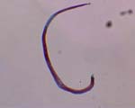 Trichinella_spiralis