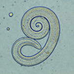 Trichinella_zimbabwensis