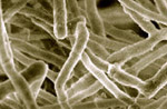 Trichoderma_reesei_QM6a