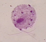 Trichomonas_vaginalis_ATCC_30188