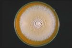 Trichophyton_mentagrophytes_TIMM_2789