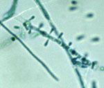 Trichophyton_rubrum_CBS_100081