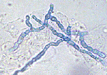 Trichophyton_tonsurans_CBS_112818