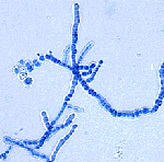 Trichophyton_verrucosum_HKI_0517