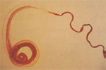 Trichuris_trichiura