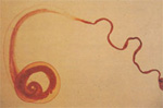 Trichuris_trichiura