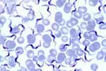 Trypanosoma_brucei_gambiense