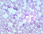 Trypanosoma_brucei_strain_Lister_427