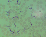 Trypanosoma_equiperdum_OVI