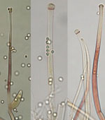 Umbelopsis_isabellina_NBRC_7884