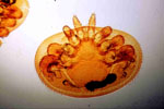 Varroa_destructor