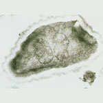 Vittaforma_corneae_ATCC_50505