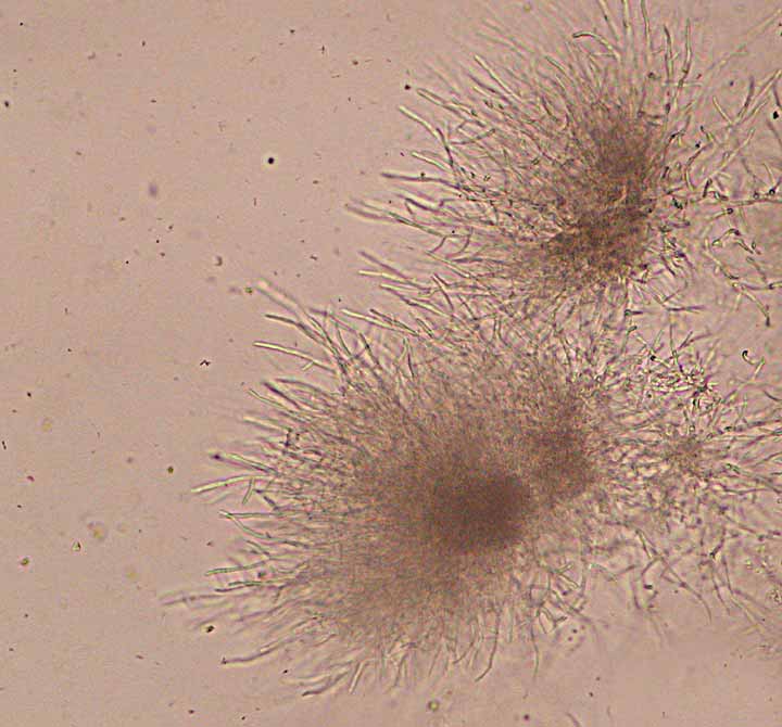 candida parapsilosis