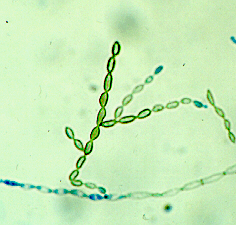 diArk | species_list | Cladophialophora_bantiana_CBS_173_52 diArk | species_list | Cladophialophora_bantiana_CBS_173_52